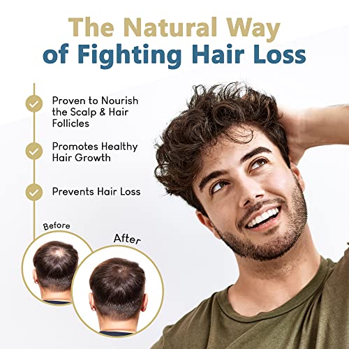 Saw Palmetto Oil for Hair Growth and Regrowth