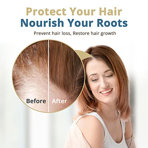 Saw Palmetto Oil for Hair Growth and Regrowth