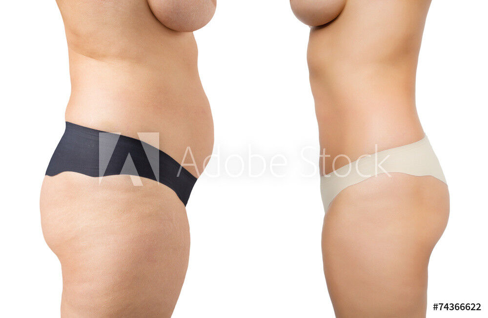 Powerful Appetite Control Capsules for Weight Loss