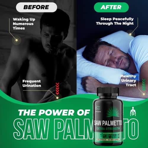Organic Saw Palmetto DHT Blocker for Prostate Health