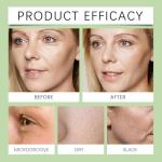 Noni Face Serum for Hydration and Brightening