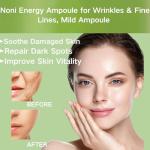 Noni Face Serum - Hydrating & Anti-Aging Fix