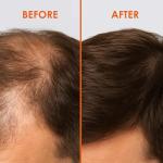 HPX ONE Men's Anti Hair Loss Shampoo - DHT Blockers