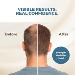 Hairmetto® Saw Palmetto Hair Growth Serum 4oz