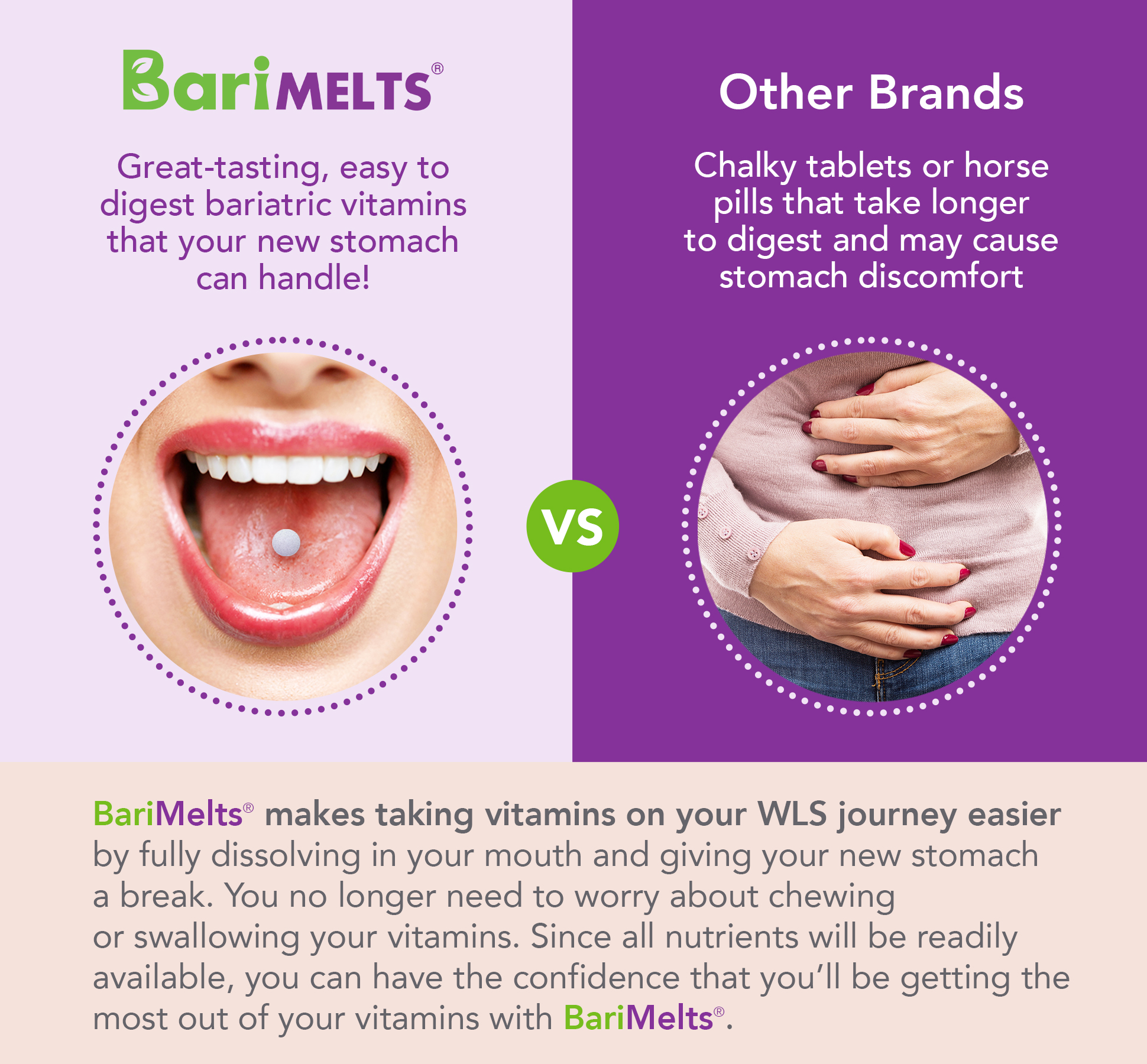 Bariatric B12 Tablets - Cherry Flavor, Sugar-Free