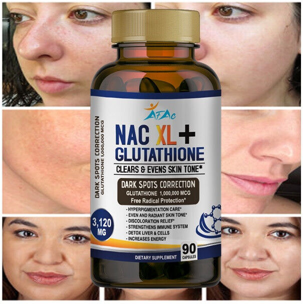 NAC N-Acetyl-Cysteine 3120mg for Respiratory Support