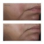 Perricone MD No:Rinse Pore Minimizing Toner 118ml