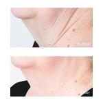 Perricone MD Neck & Jawline Firming Cream