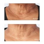 Perricone MD Neck & Jawline Firming Cream