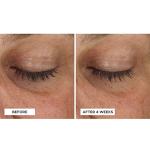 Perricone MD Eye Cream for Dark Circles & Puffiness