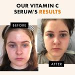 Eclat Skincare Vitamin C Serum for Bright Skin