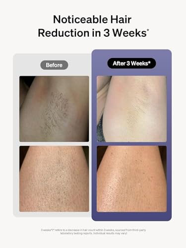 Ulike Air 3 IPL Laser Hair Removal Device