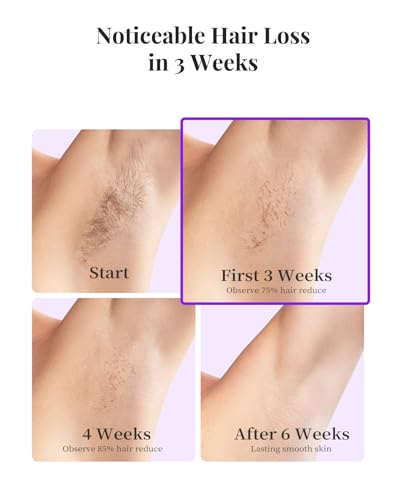 Hikyskin IPL Hair Removal Device with Cooling Tech