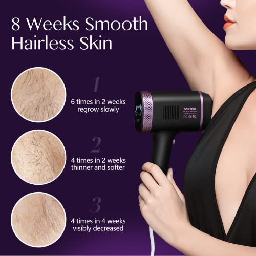IPL Hair Removal Device with 2 Attachments