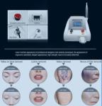 Laser Tattoo Removal Machine for Eyebrows, Lips, and Skin