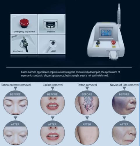 GURSAC Professional Laser Tattoo Removal Machine