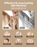 Glattol IPL Hair Removal Device for Home Use