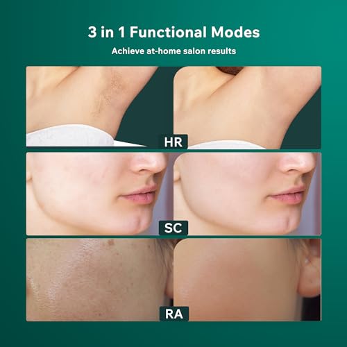 AMINZER 3-in-1 IPL Hair Removal Device