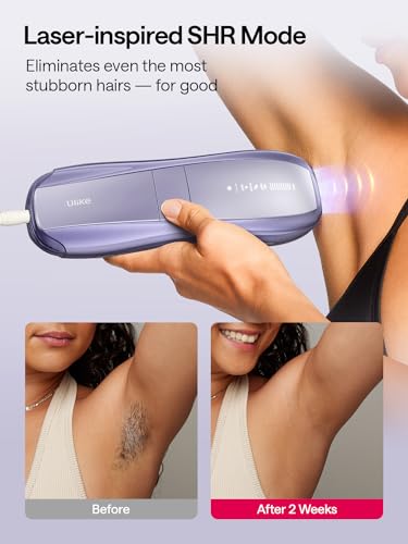 Ulike Air 10 IPL Laser Hair Removal Device