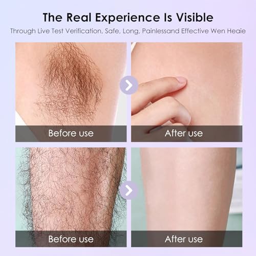 Rechargeable Electric Shaver for Women, Portable Trimmer