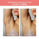 FOREO PEACH IPL Hair Removal Device