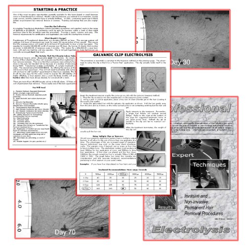 Aavexx 300 Transdermal Epilation System for Home Use