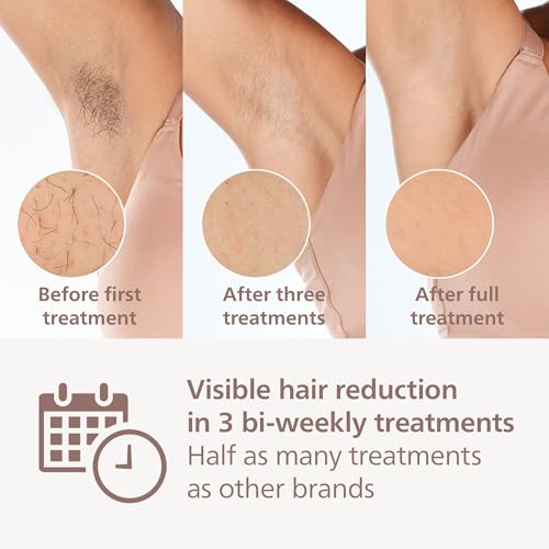 Philips Lumea IPL Prestige Hair Removal Device