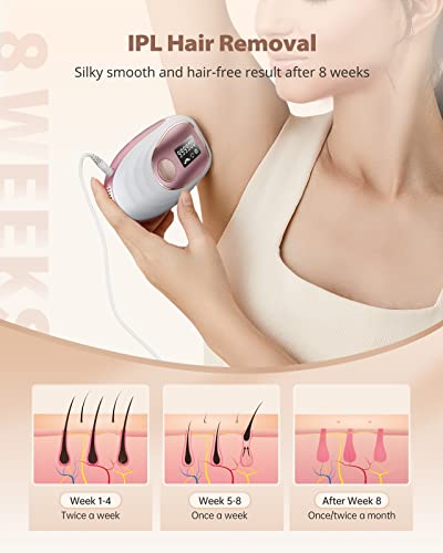 ZKMAGIC IPL Laser Hair Removal Device