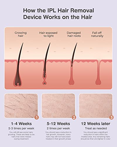 Gentle Hair Removal IPL Device for Men and Women