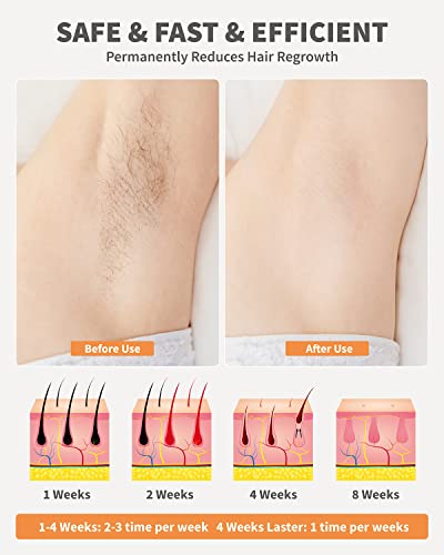 GERCY IPL Hair Removal Device for Smooth Skin