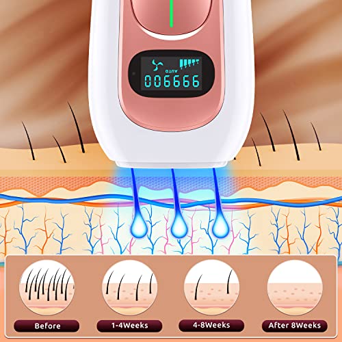 Upgraded IPL Hair Removal Device for All Skin