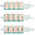 Ponyta IPL Laser Hair Removal for Women