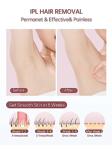 LYSMOSKI IPL Hair Removal Device with Cooling System