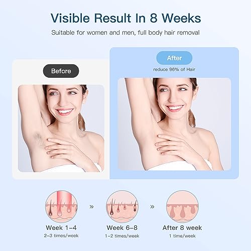 Painless IPL Hair Removal Device with Cooling System