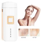 ANLAN Handheld Laser Hair Removal Device