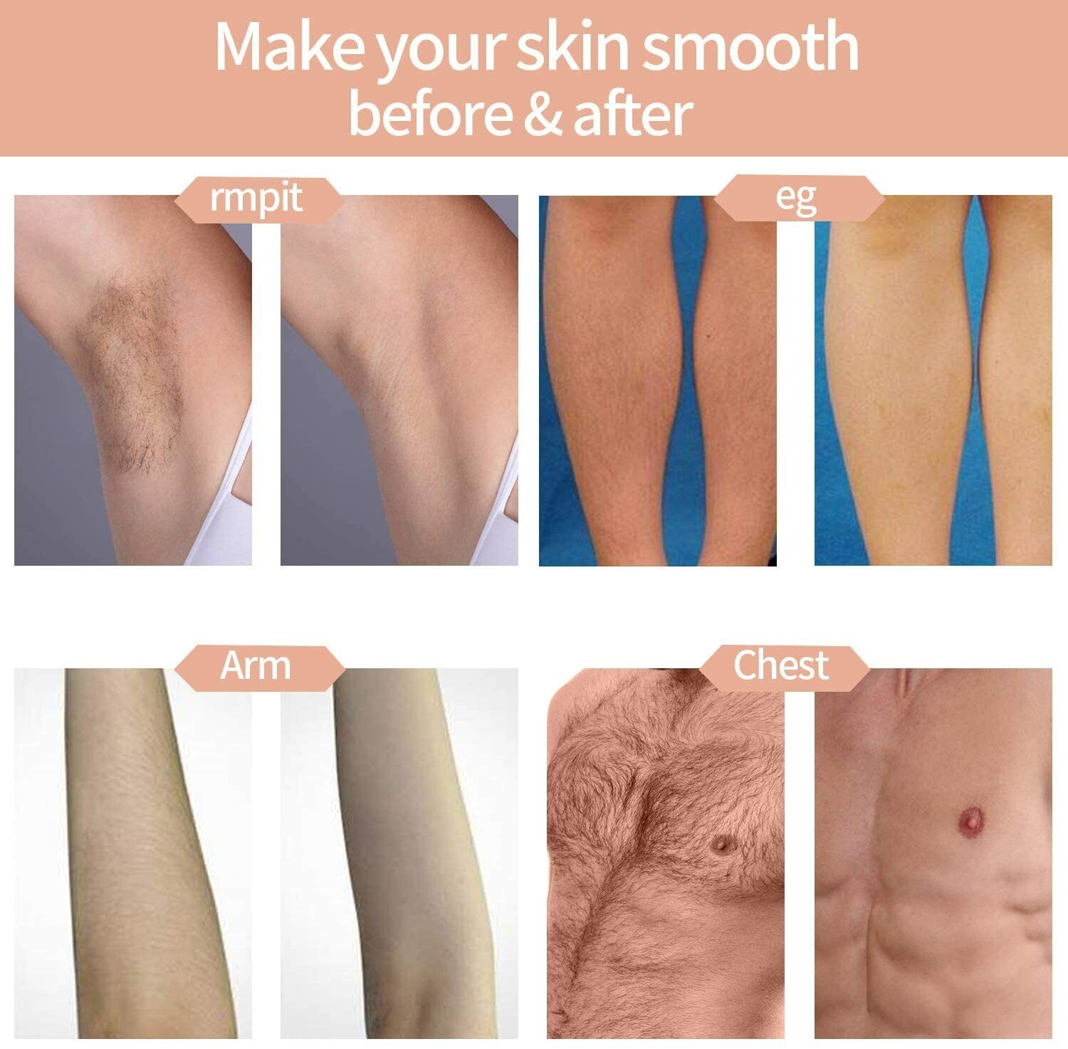 IPL Laser Hair Removal Machine for Smooth Skin