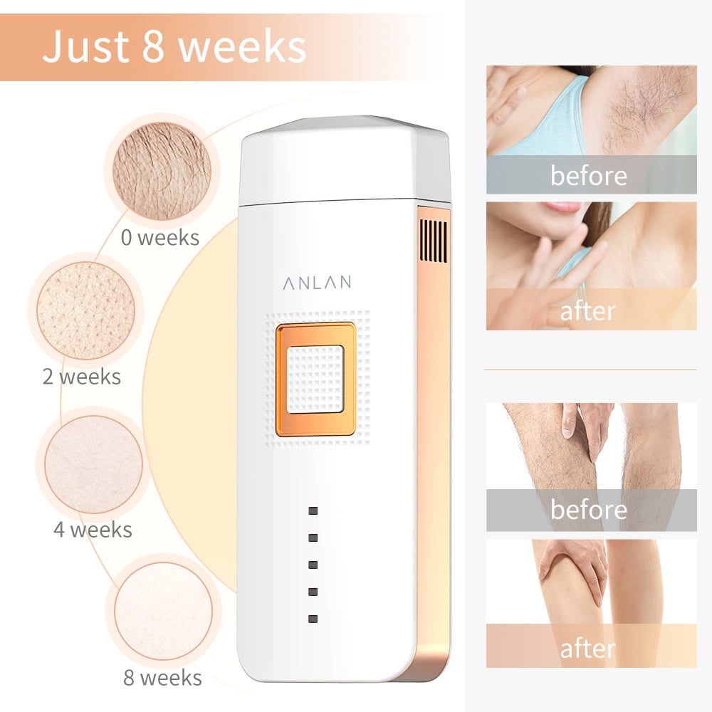 ANLAN Handheld Laser Hair Removal Device