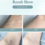 TureClos 900000 Flashes Painless Laser Hair Removal