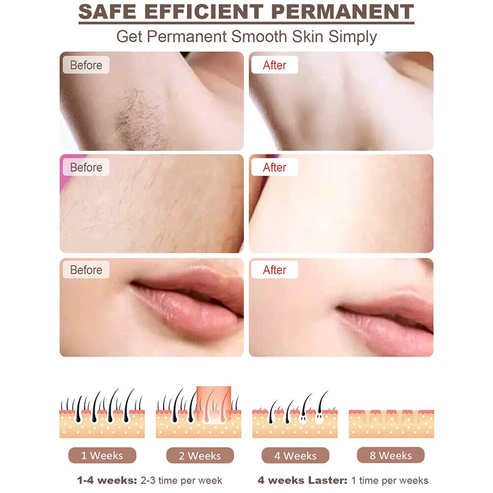 IPL Hair Removal Device with 5 Modes