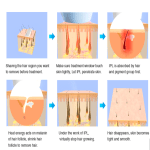 3-in-1 IPL Laser Hair Removal Machine Kit