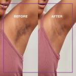 Sugar Wax Roller Kit for Body and Pubic Hair