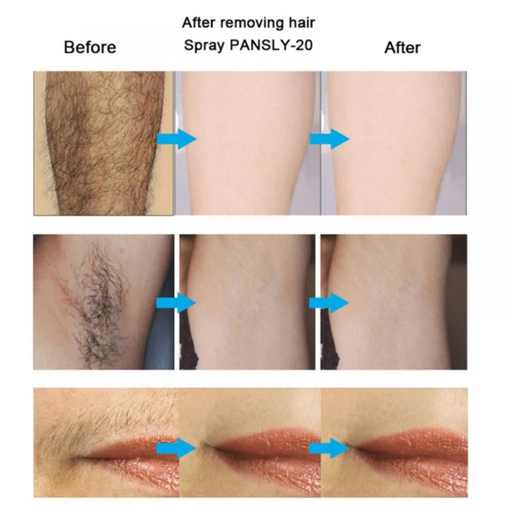 30ML Hair Removal Inhibitor Oil for Body & Face