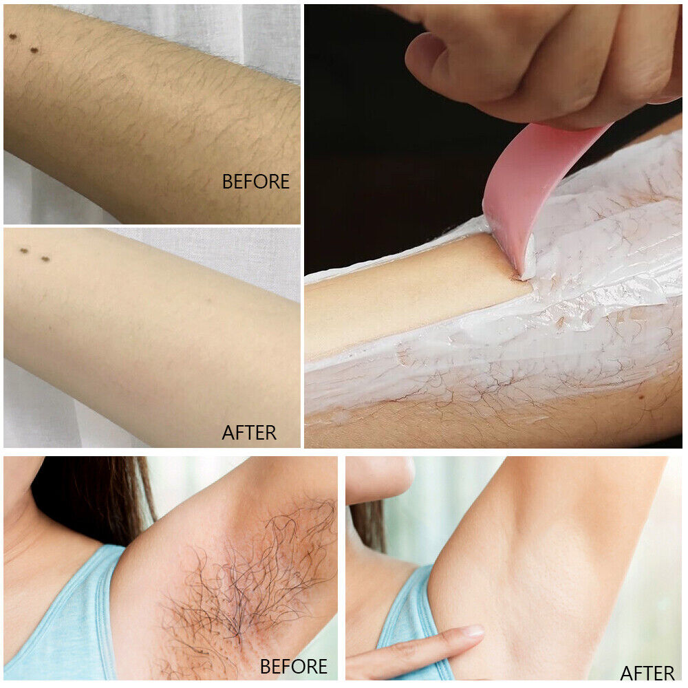 Gentle Body Hair Removal Cream for All Areas