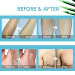 Natural Hair Removal Spray Foam - Latest Formula