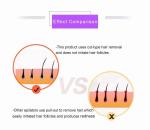 Painless Women’s Facial and Body Hair Remover