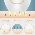 IPL Hair Removal Device for Painless Home Use