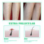 Exfoliating Brush for Smooth Skin and Bump Prevention