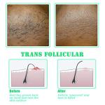 Exfoliating Brush for Smooth Skin and Bump Prevention