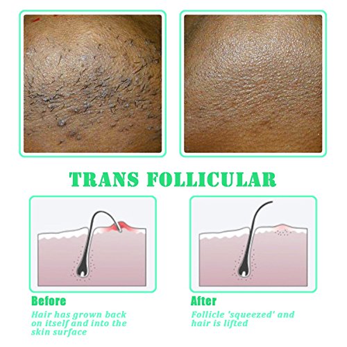 Exfoliating Brush for Smooth Skin and Bump Prevention