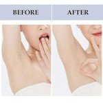 Women's Hair Removal & Ingrown Hair Serum - 20ml